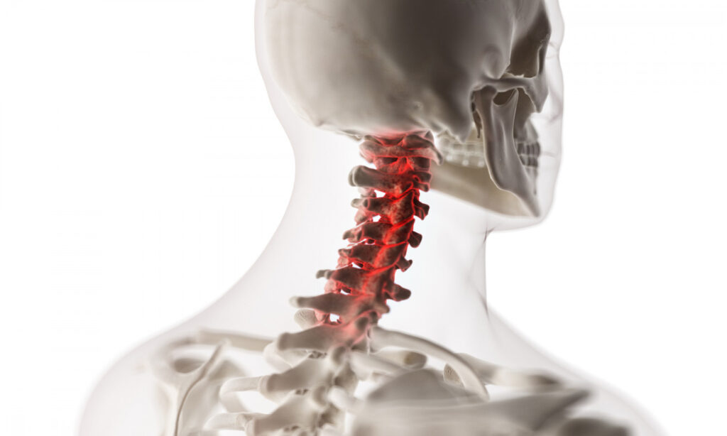 physical therapy for osteoporosis