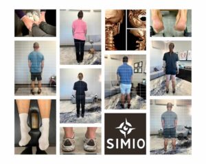 a collage of images showing examples of body asymmetry including shoulders at different heights, differently sized calves and leg length discrepancies